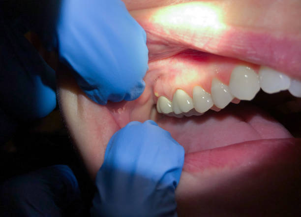 Best Tooth Pain Emergency Relief  in Lakeview, GA